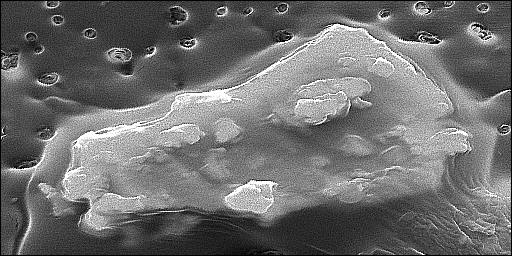 electron microscope image