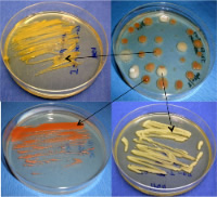 bacteria cultures
