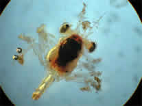 Microscope photo of crab larvae.