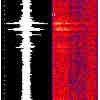 tremor spectrogram