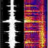 tremor spectrogram