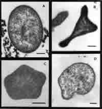 images of hyperthermophile bacteria, click for full size