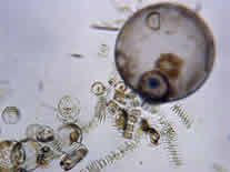 phytoplankton image - microscope