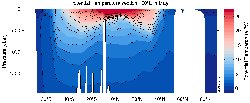 MIMOC Potential Temperature section West Pacific Ocean 160°E