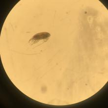 Zooplankton specimen photographed through the microscope